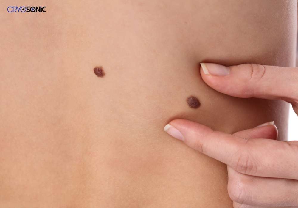 Infection Risk and Poor Aftercare Bicester
