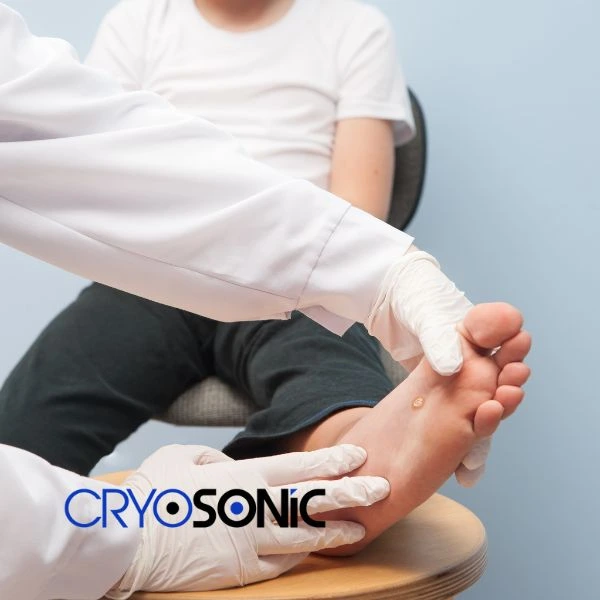 Are you looking for fast effective wart removal Contact us today Bicester